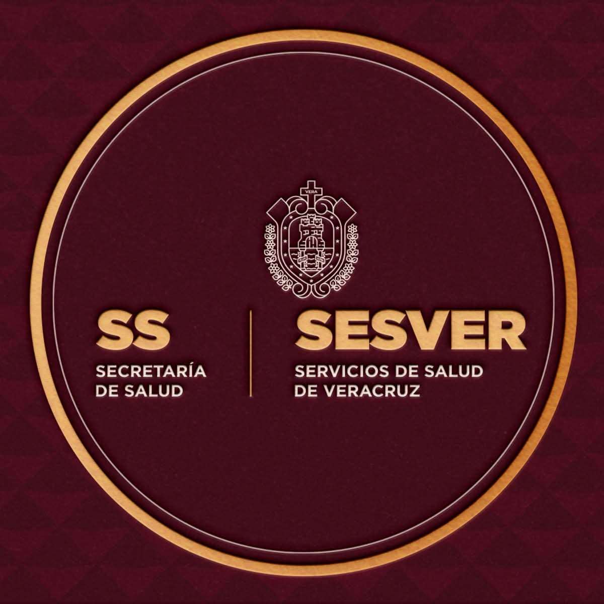 No hay brote de tuberculosis en la SEV: SS